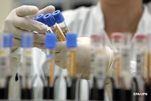 Первый случай за последние пять лет: в США выявлено заболевание чумой